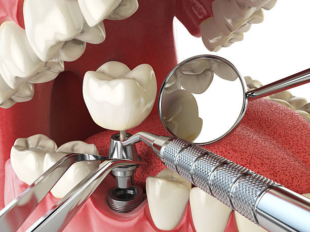 Best Urgent Care for Lost Fillings or Crowns in Crouch Mesa, NM